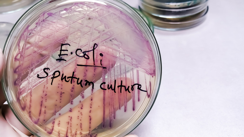 Petri dish, labeled as an E. coli culture, with the bacteria stained purple to be visible.