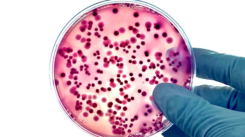 Salmonella and e-coli on dish
